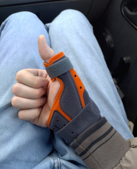 A thumb brace shows a thumbs-up gesture.